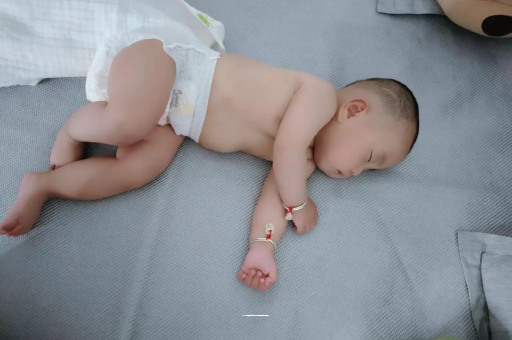 惠东宝宝头上长痱子